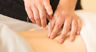 鍼灸施術　画像